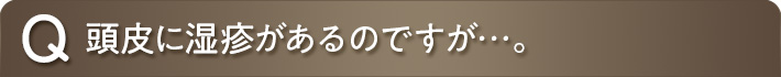 頭皮に湿疹があるのですが…。